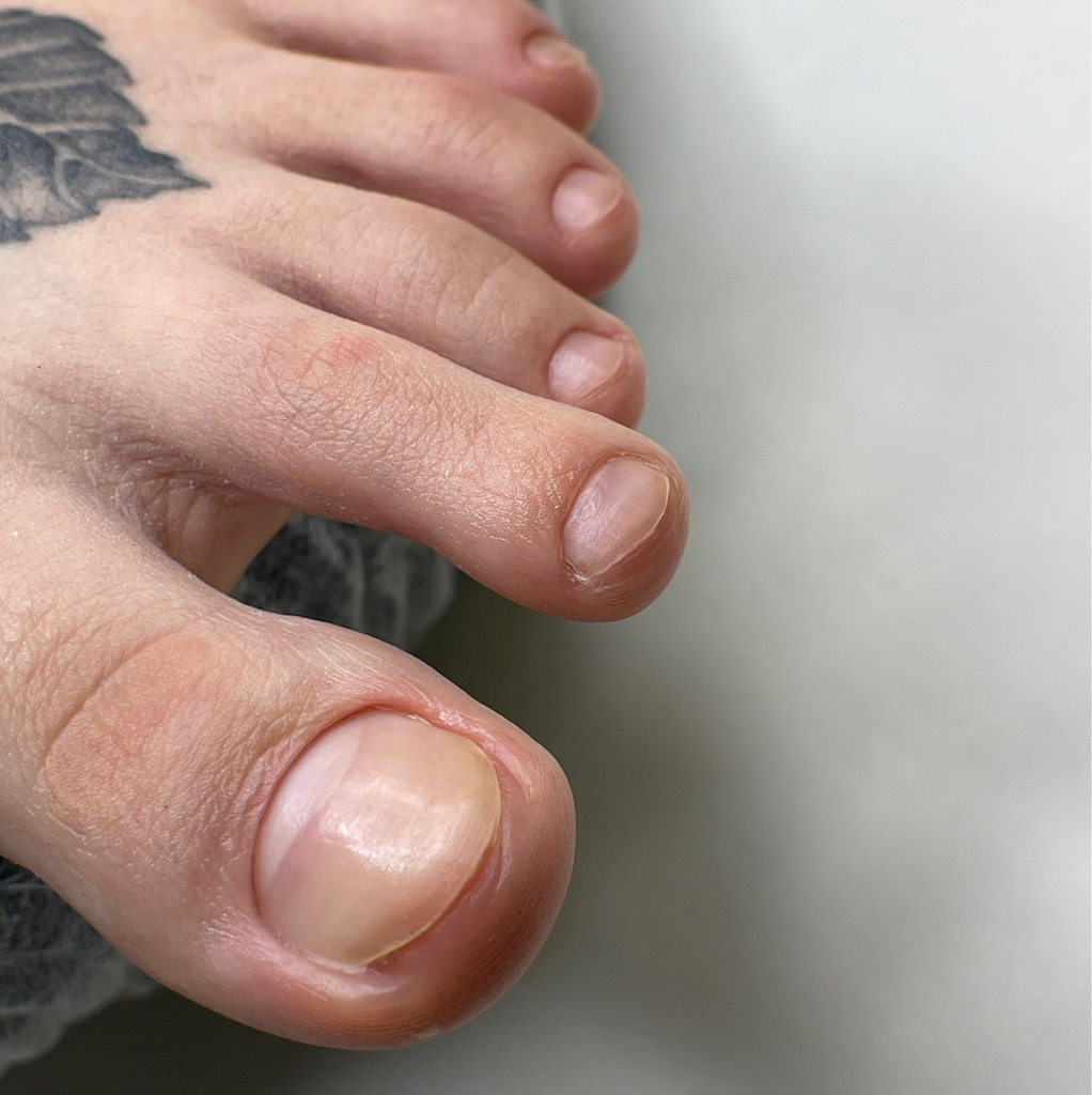 Гигиена пальчиков педикюр