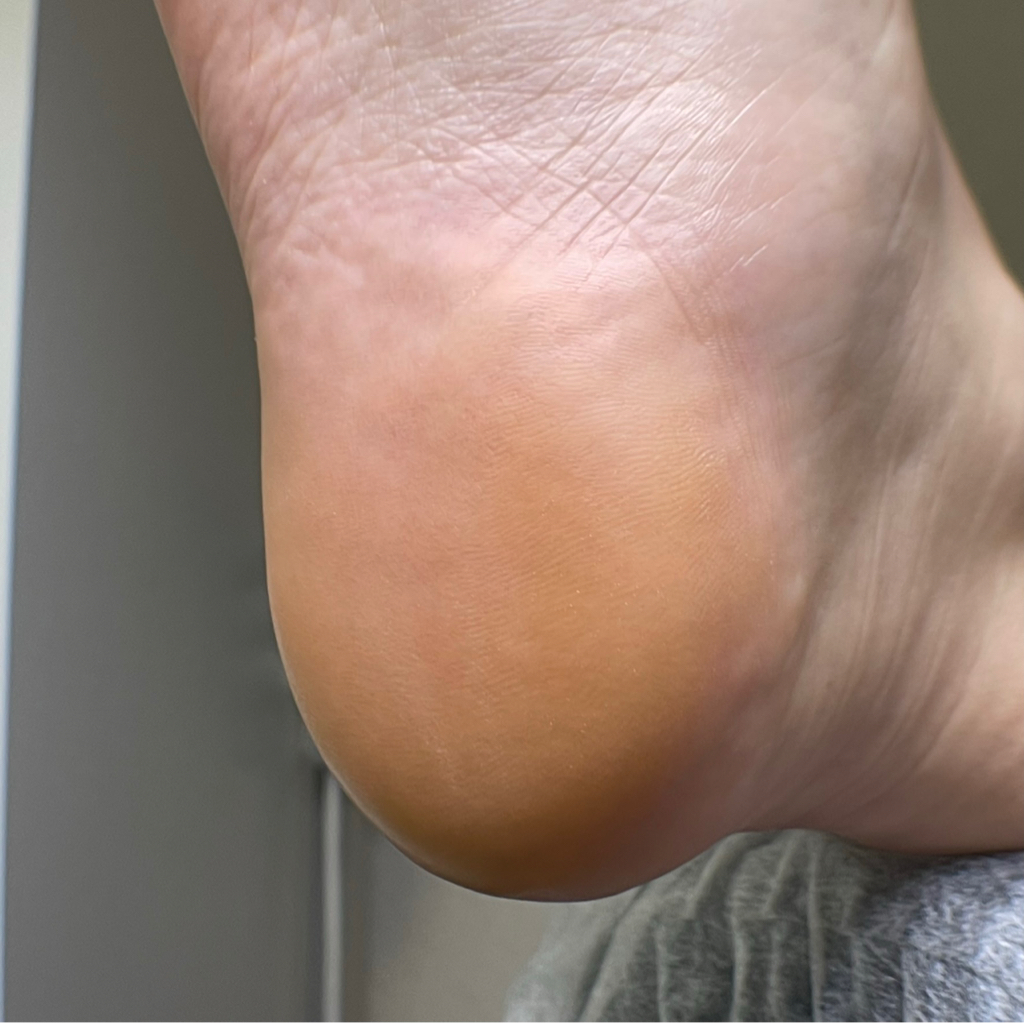 Педикюр обработка стопы