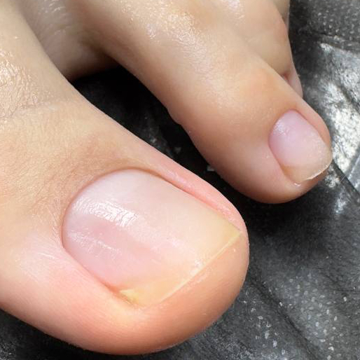 педикюр полный без покрытия «стопа+пальчики»