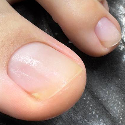 педикюр пальчики без покрытия