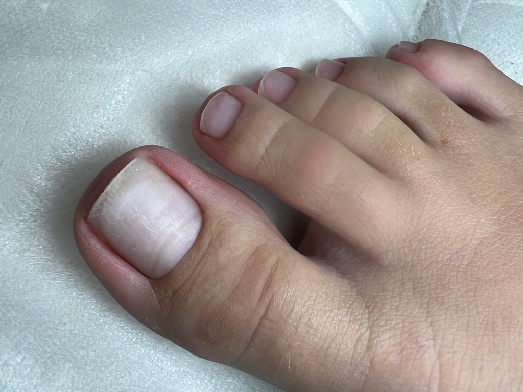 Педикюр гигиена