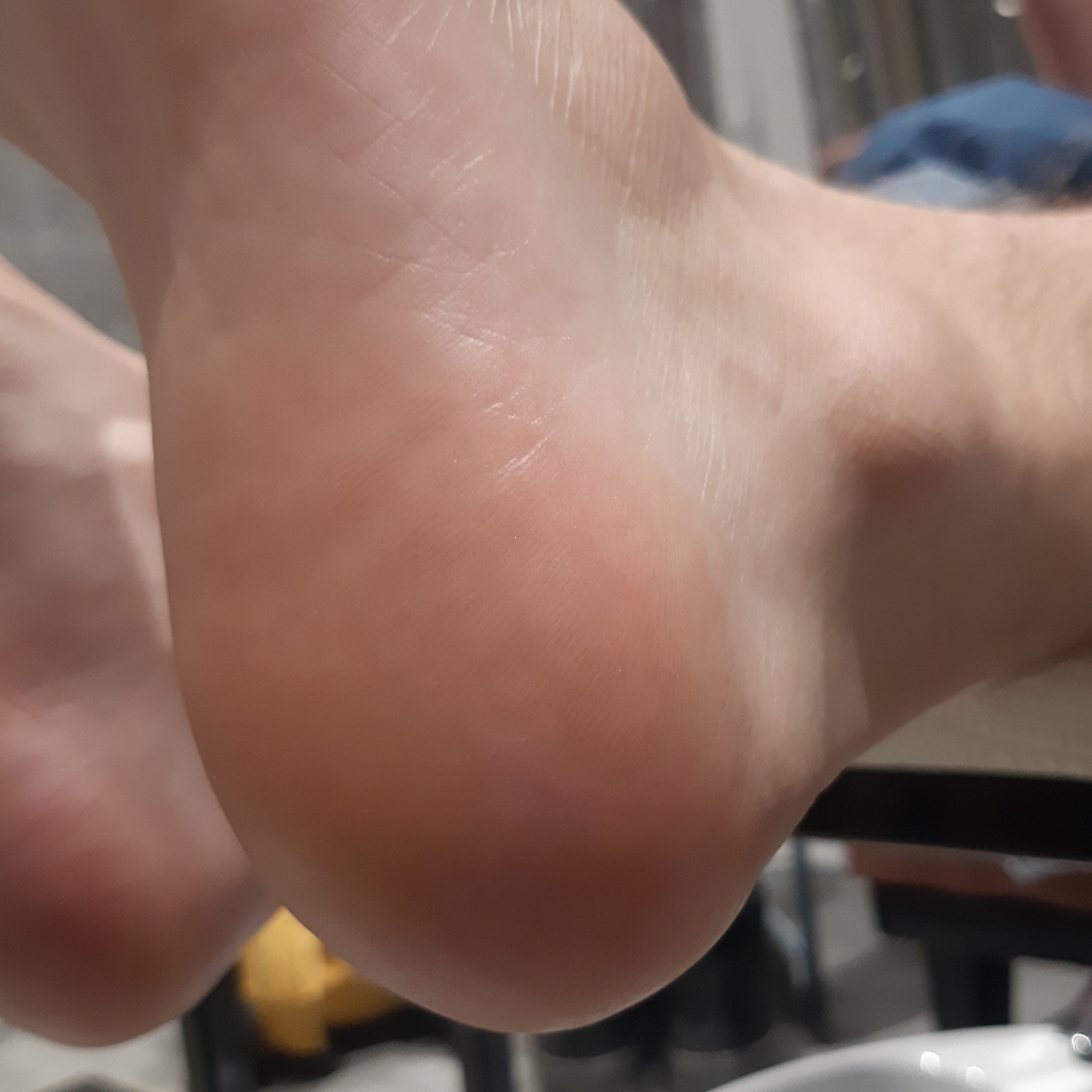 Обработка стопы