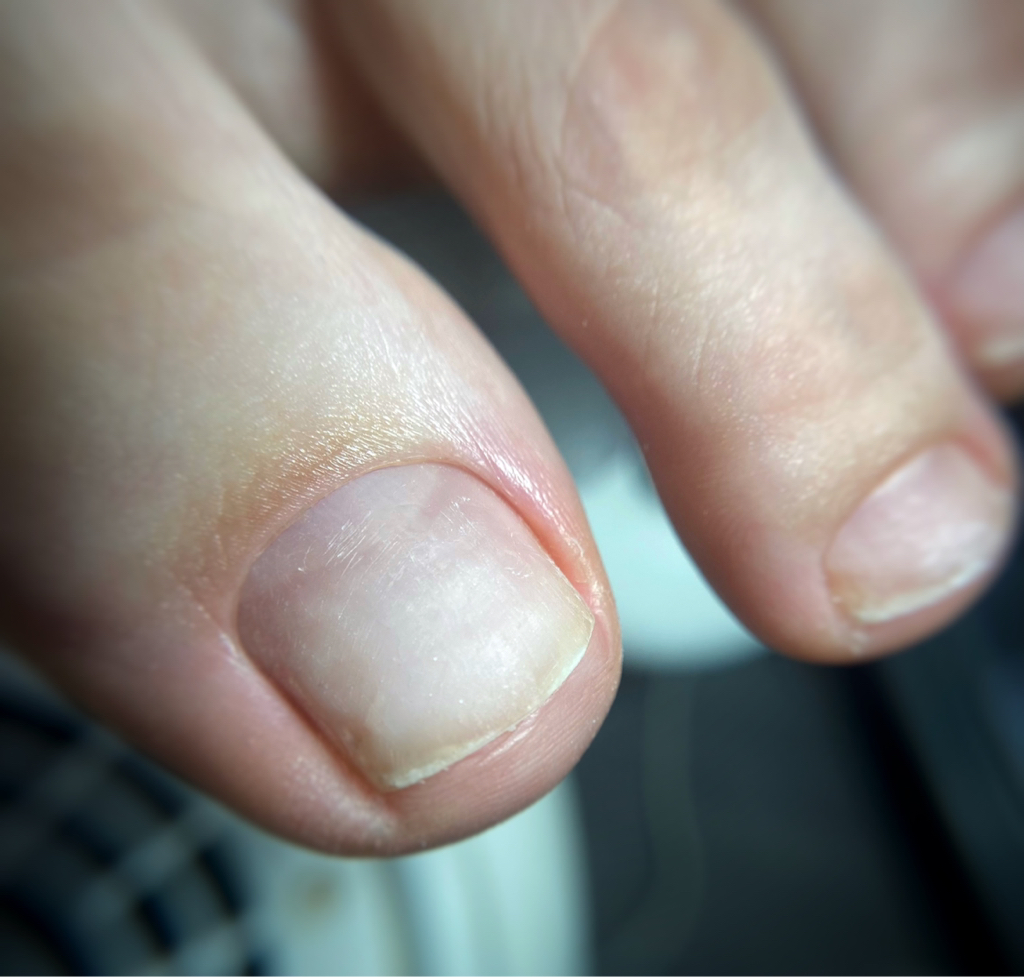 Снятие покрытия + обработка пальчиков