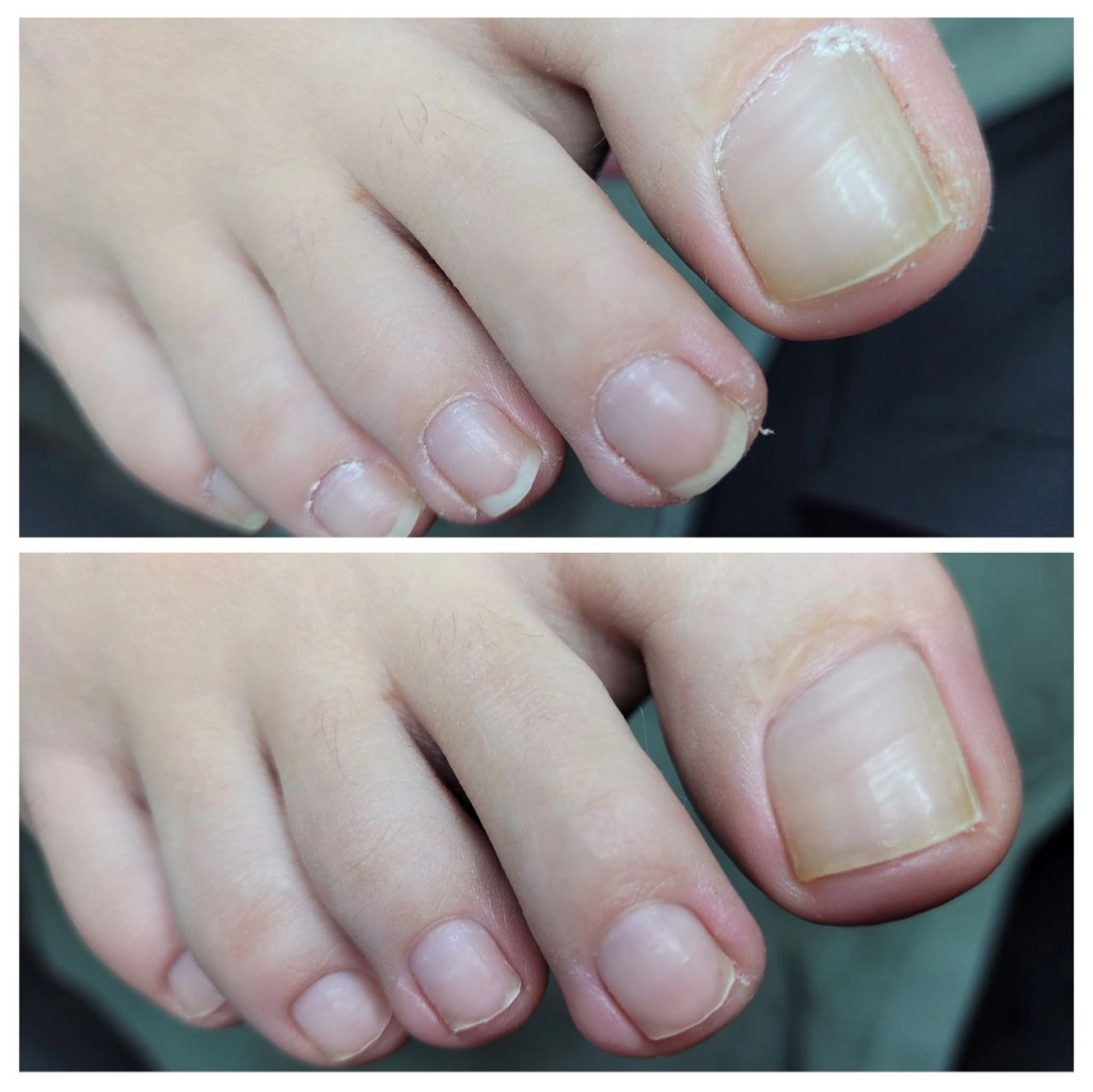 Гигиенический педикюр ( обработка стопы + пальцы) без покрытия