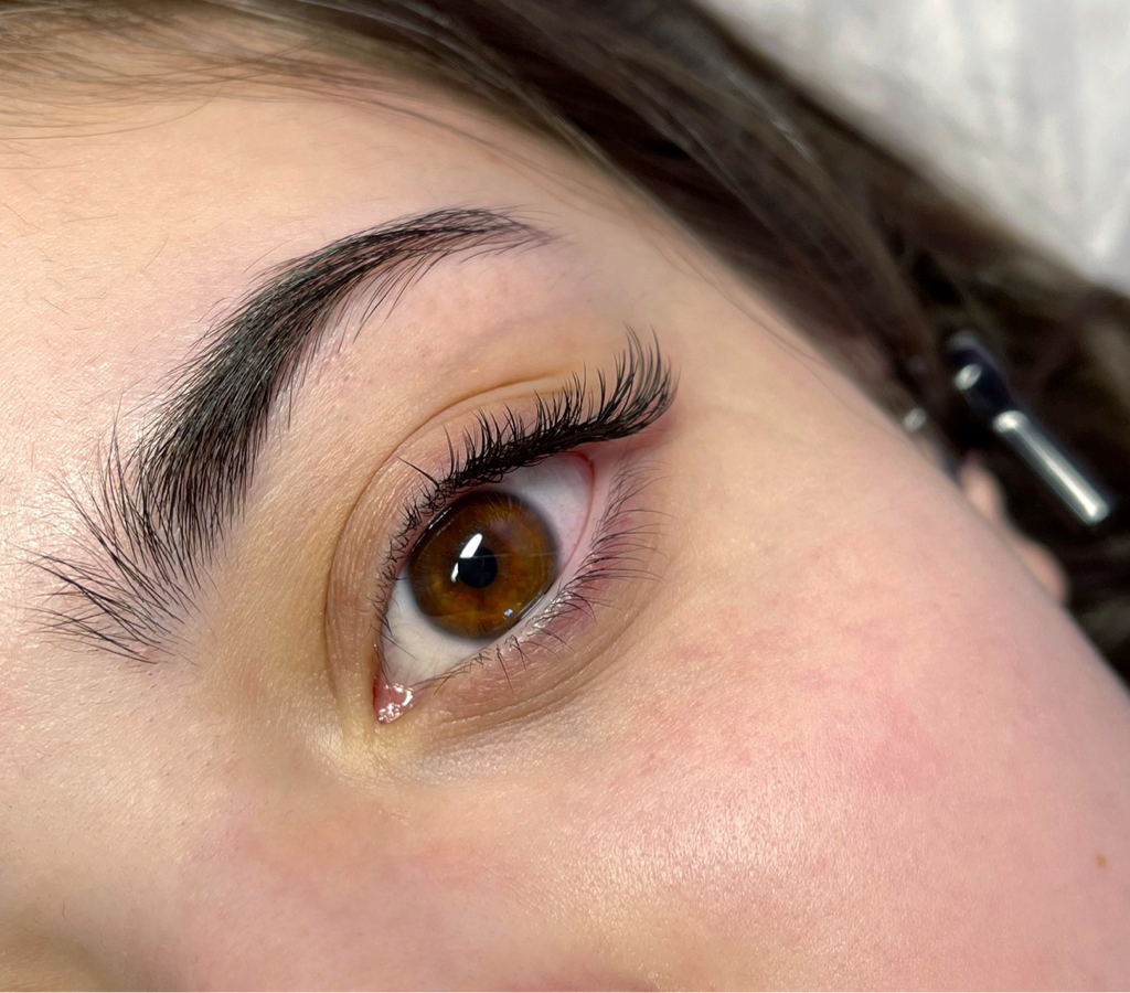 Уголки глаз