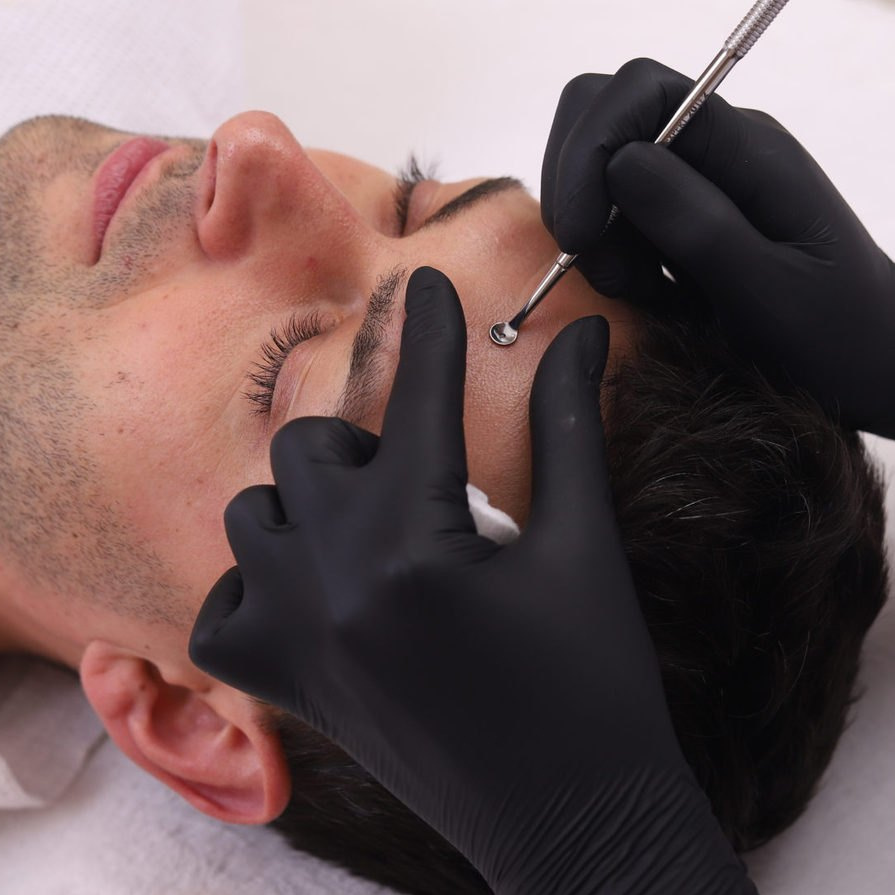 Уз чистка лица