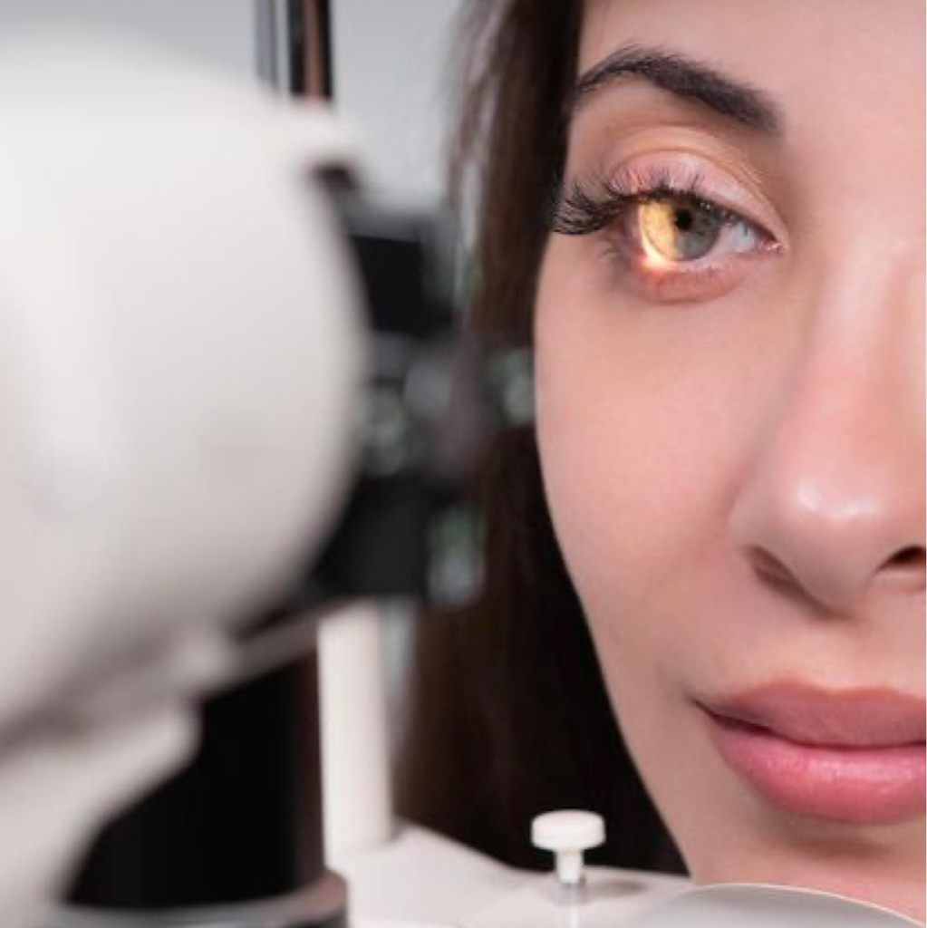 Подбор астигматических и мультифокальных мягких контактных линз для пациентов,  ранее носивших контактные линзы