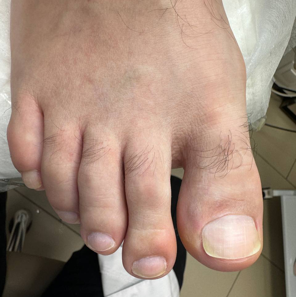 Педикюр мужской