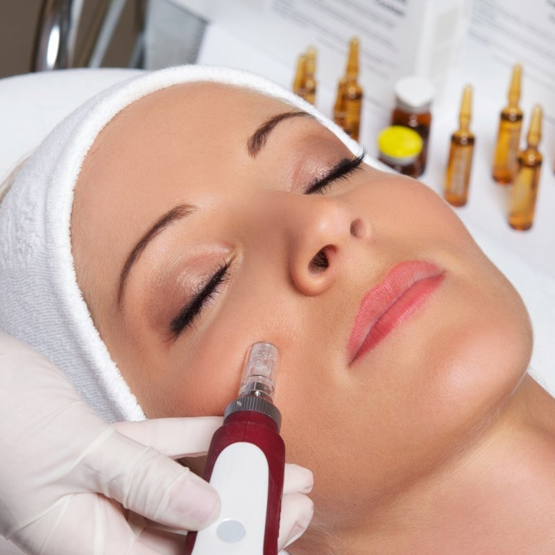 Фракционная мезотерапия шея