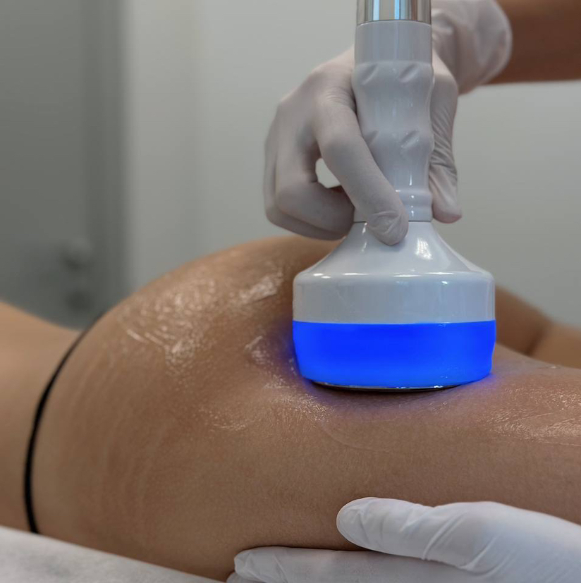 Кавитация (1 зона)