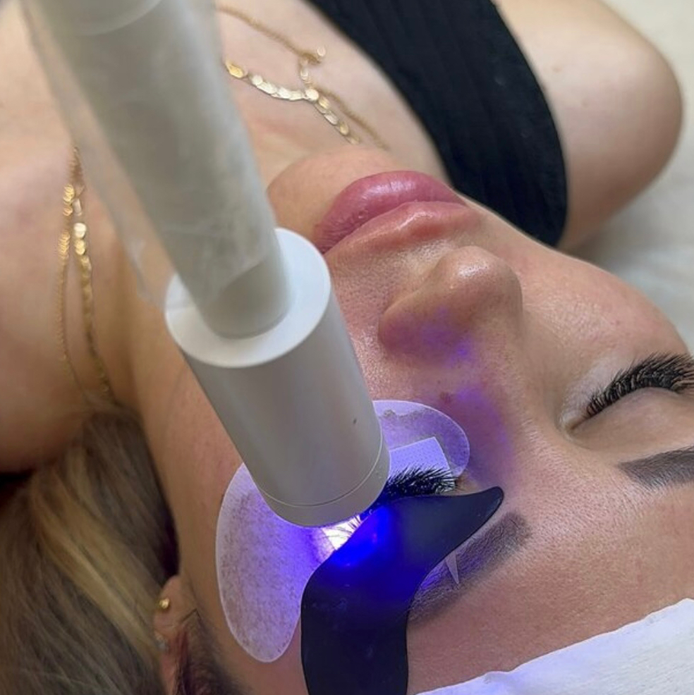 LED Наращивание уголки