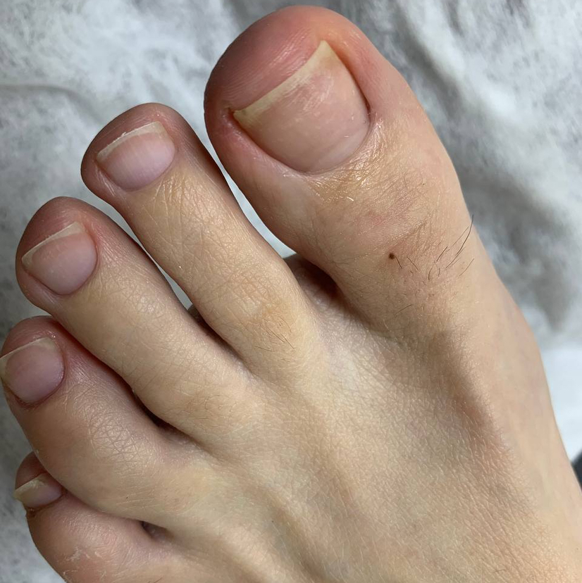 Педикюр пальчики без стоп