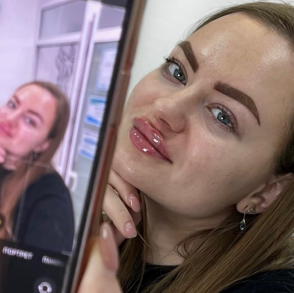 Увеличение губ 1мл