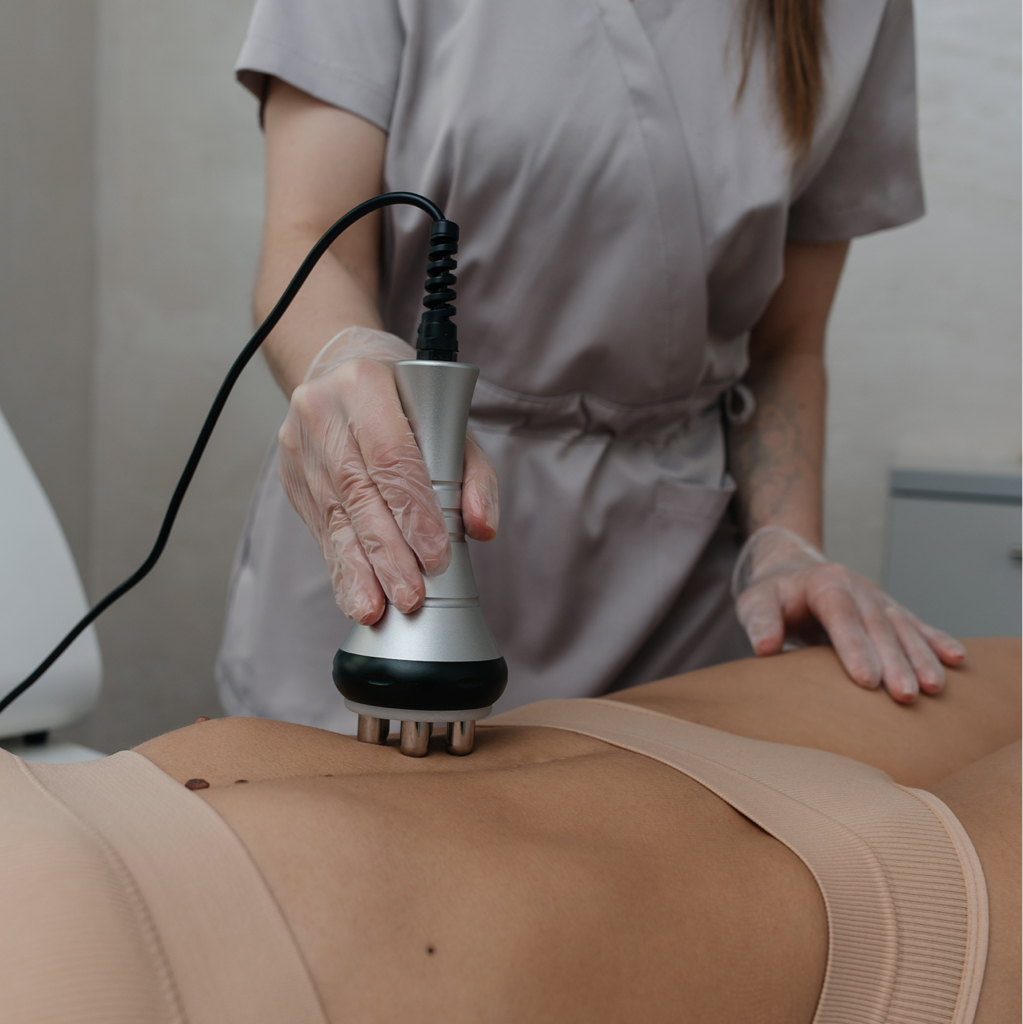 RF лифтинг тела