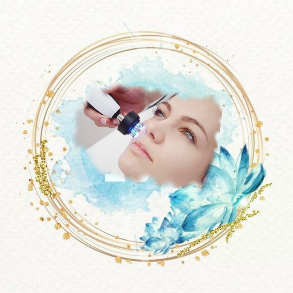 RF-лифтинг лица