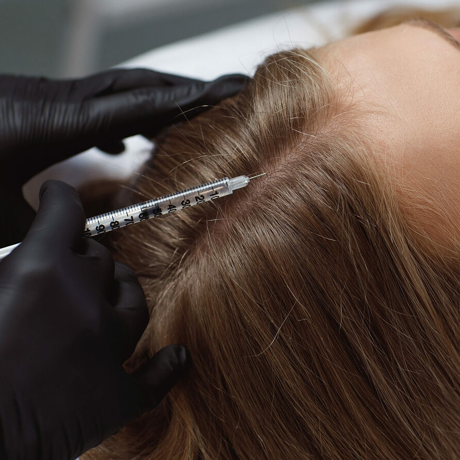 Мезотерапия кожи головы (волосы)