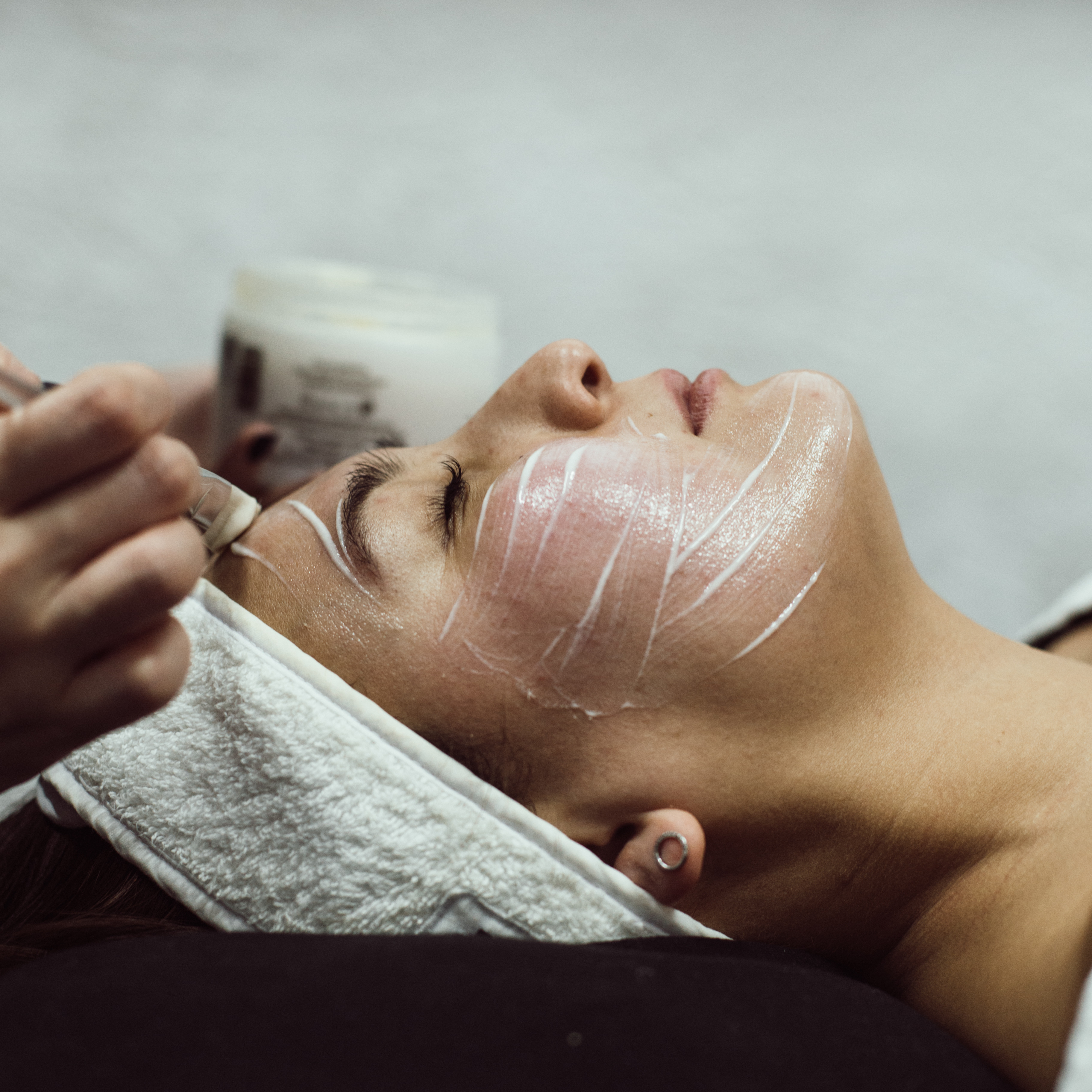 Карбоновый пилинг