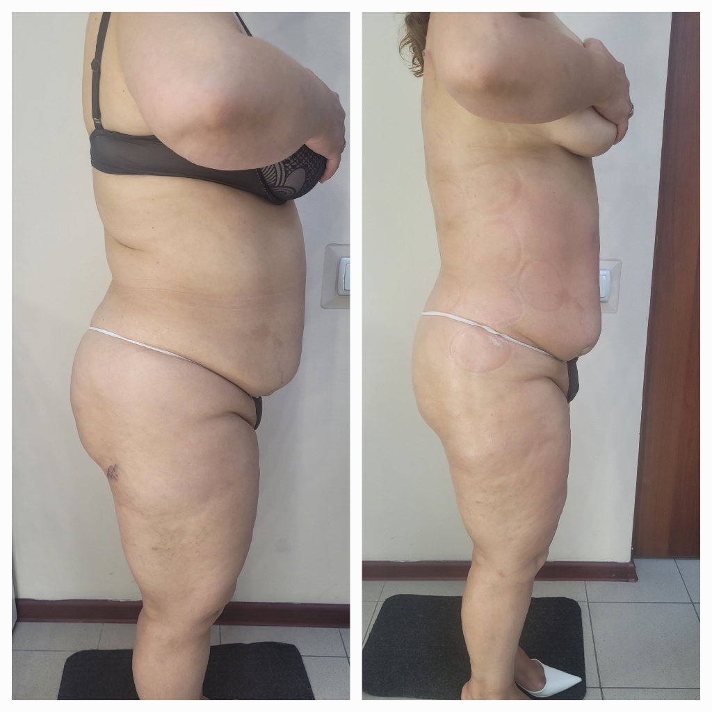 пакет "Линии тела"