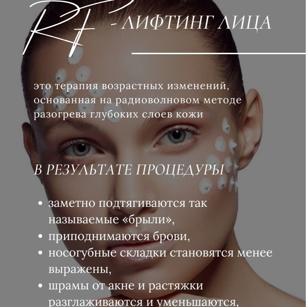 Rf-лифтинг