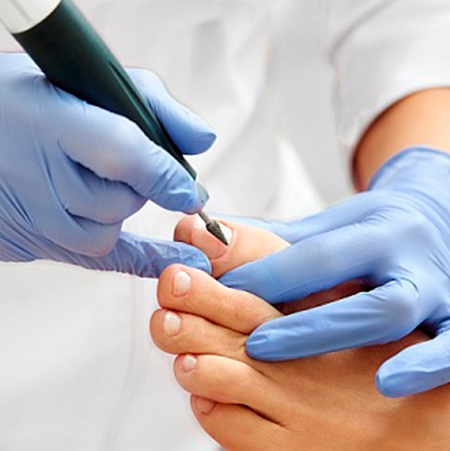 Обработка грибка