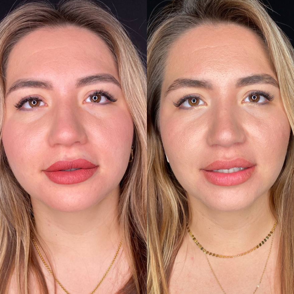 Коррекция перманента губ (не позднее 2х мес)