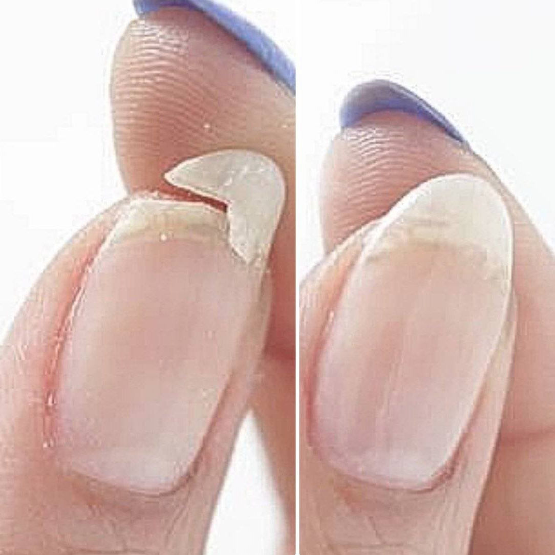 Ремонт ногтя