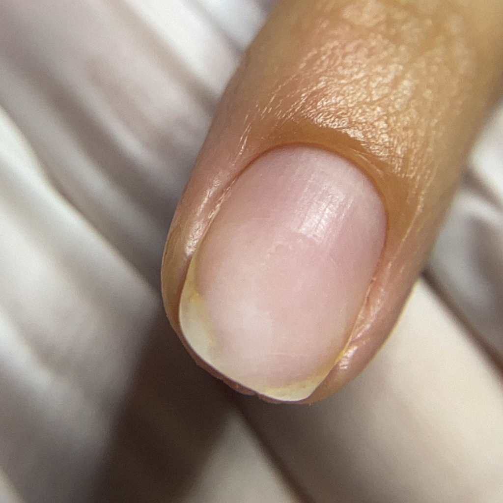 Снятие БЕЗ покрытия и обработки (опил формы входит в услугу)