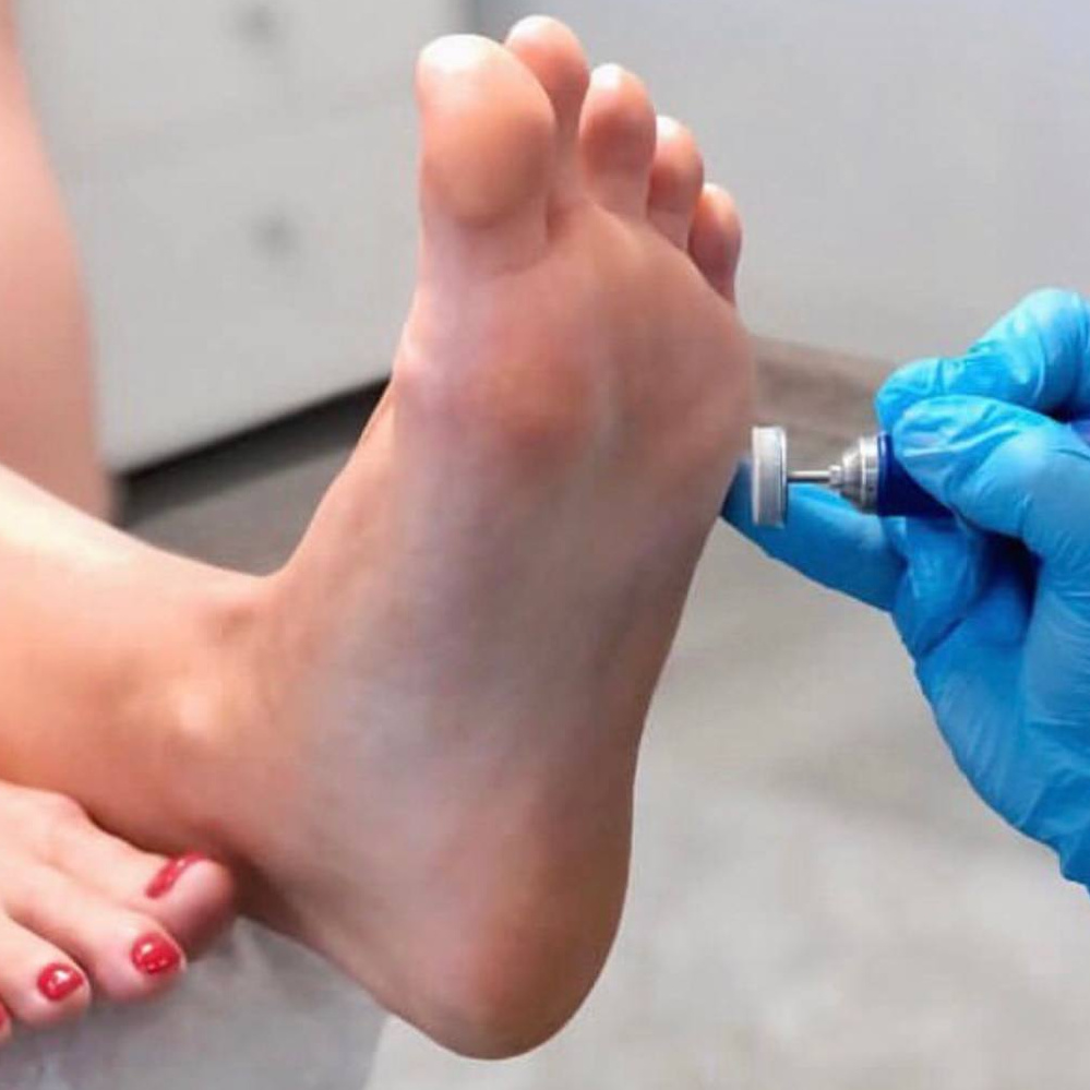 Обработка стопы Smart