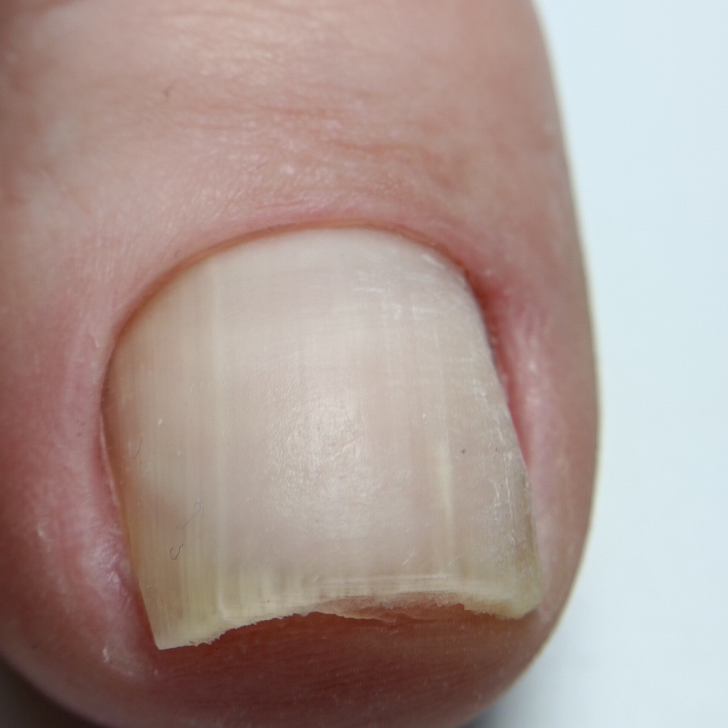 Гигиенический педикюр