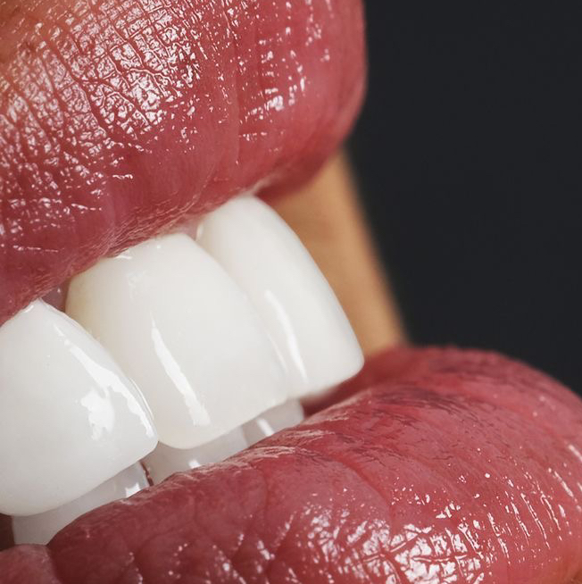 Консультация