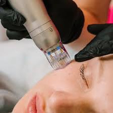 Pf микроигольчатый зона вокруг глаз При покупке абонемента-10%