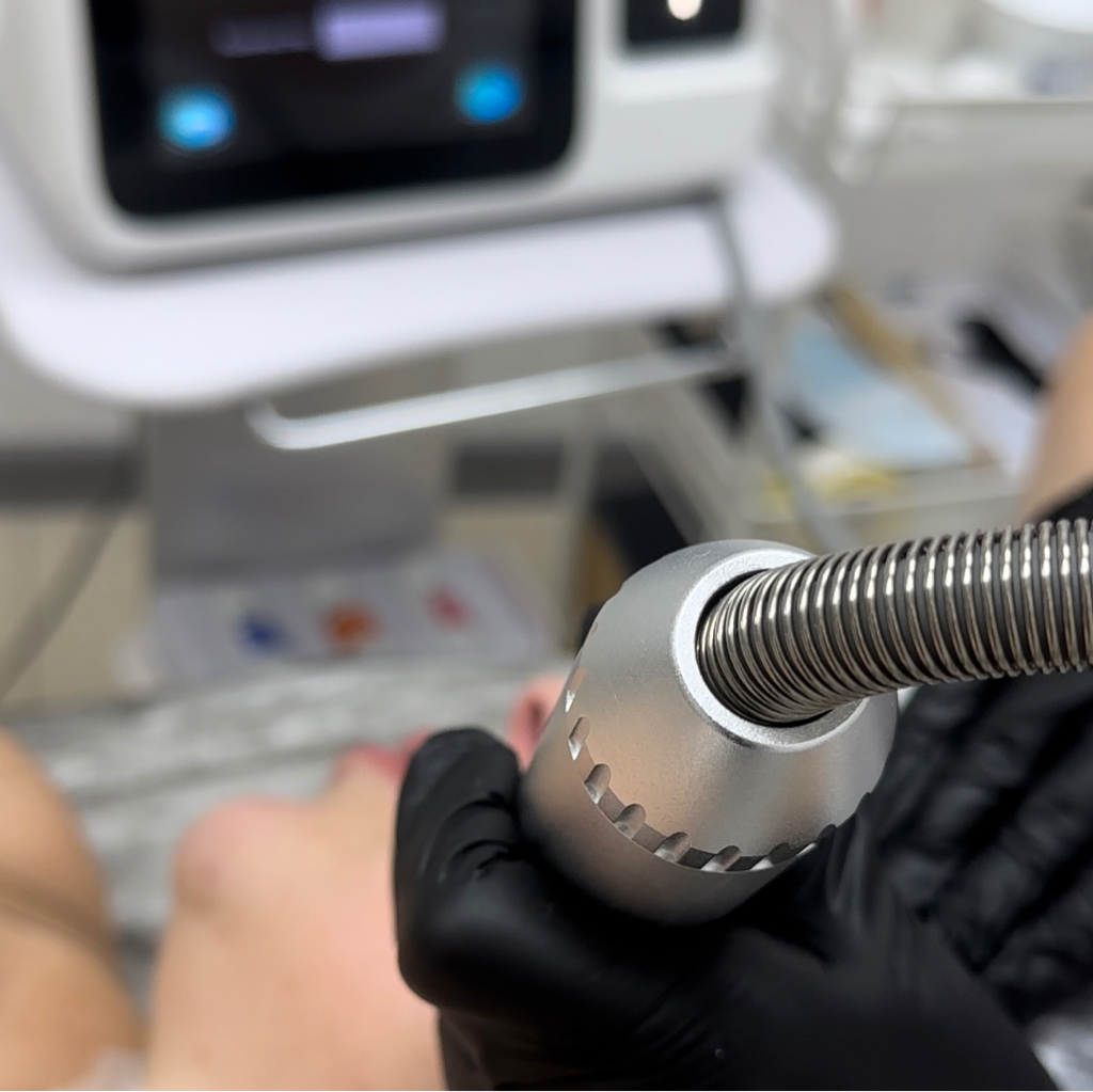 Rfмикроиголчатый  Лицо шея декольте При покупке абонемента-10%