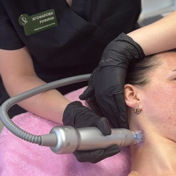 Микроигольчатый RF-лифтинг шеи