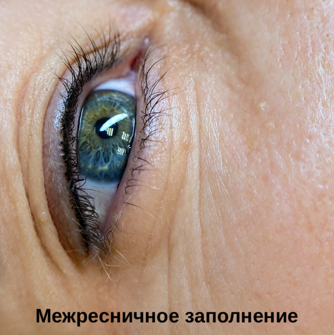 Перманент межресничного пространства