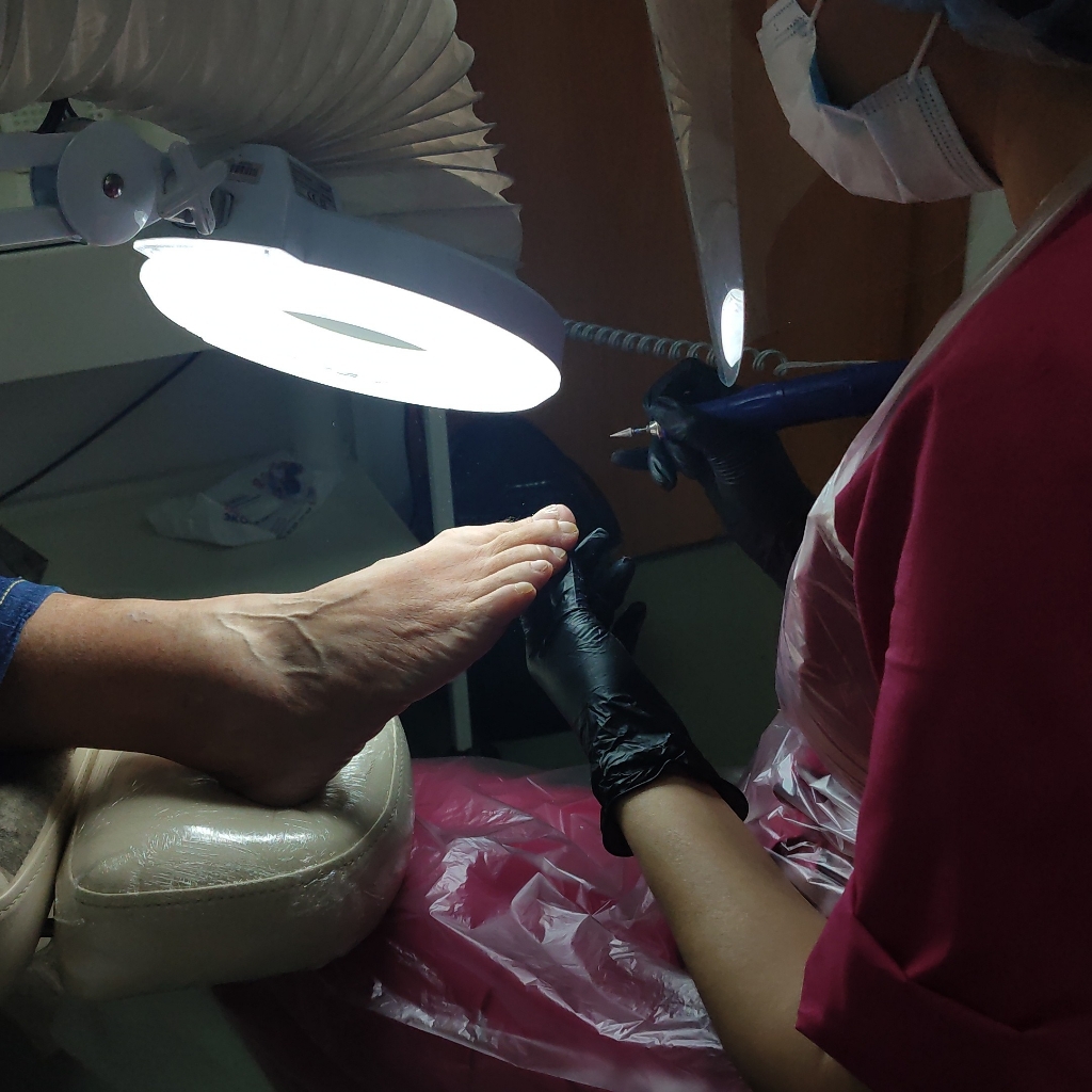 Подологический педикюр