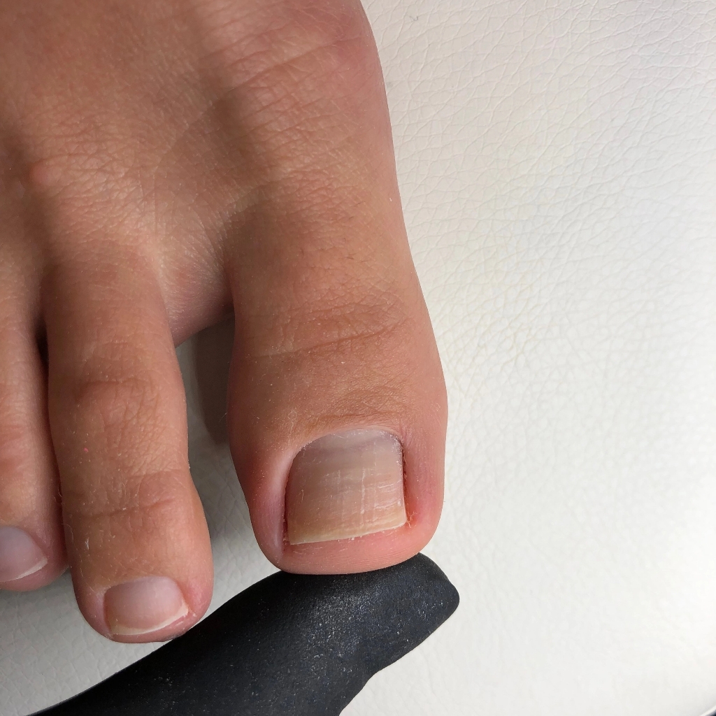 Полный гигиенический педикюр без покрытия