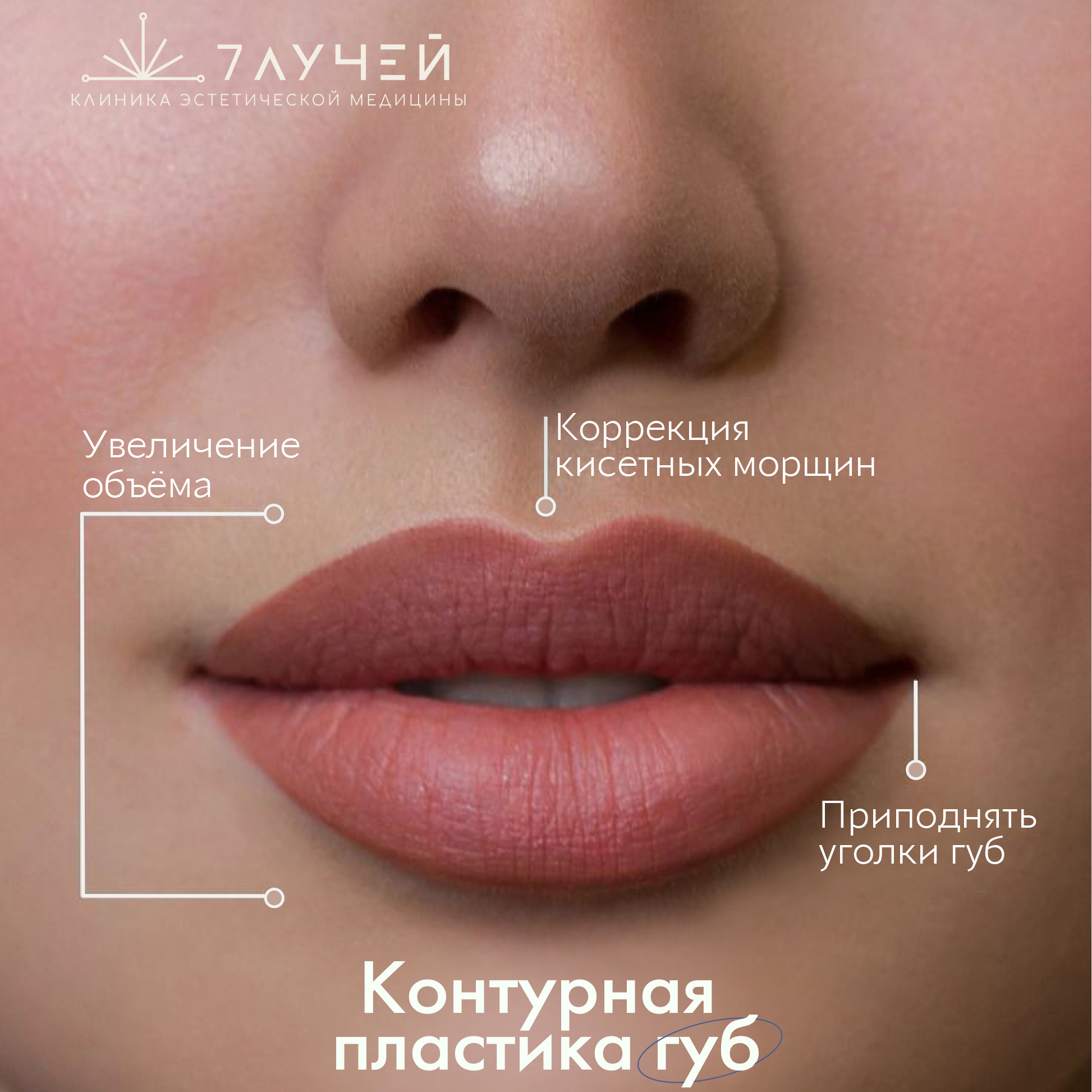 Контурная пластика губ