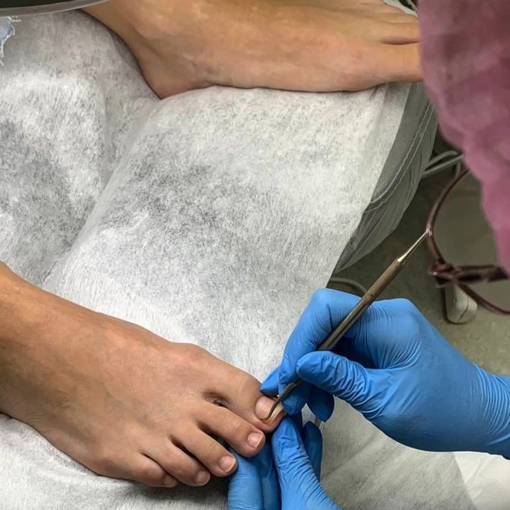 Мужской педикюр