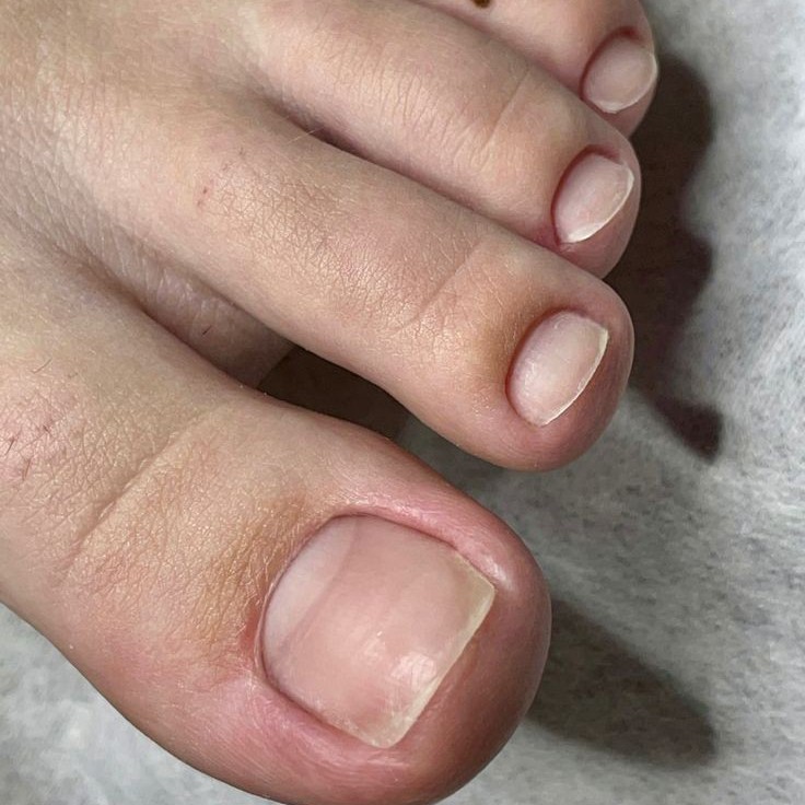 Мужской педикюр ( обработка пальцев)