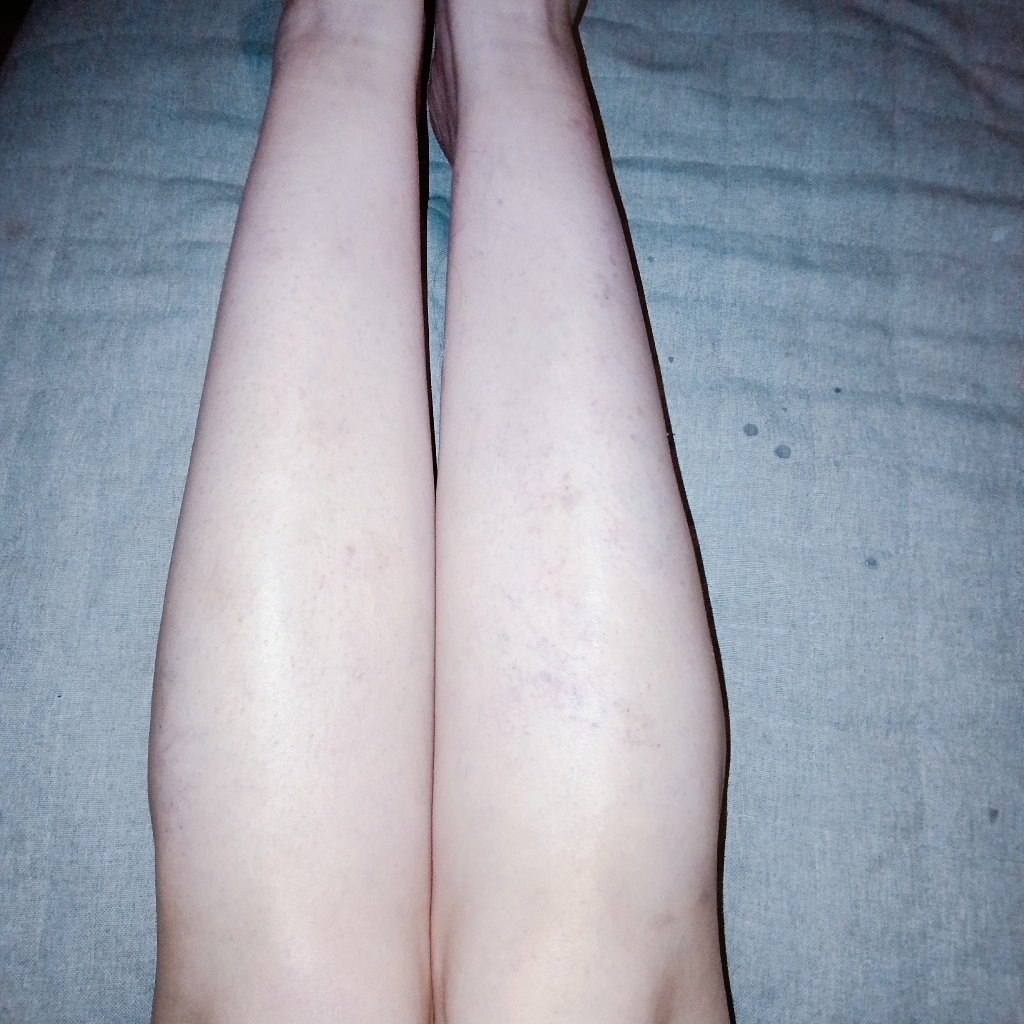 Депиляция воском голени