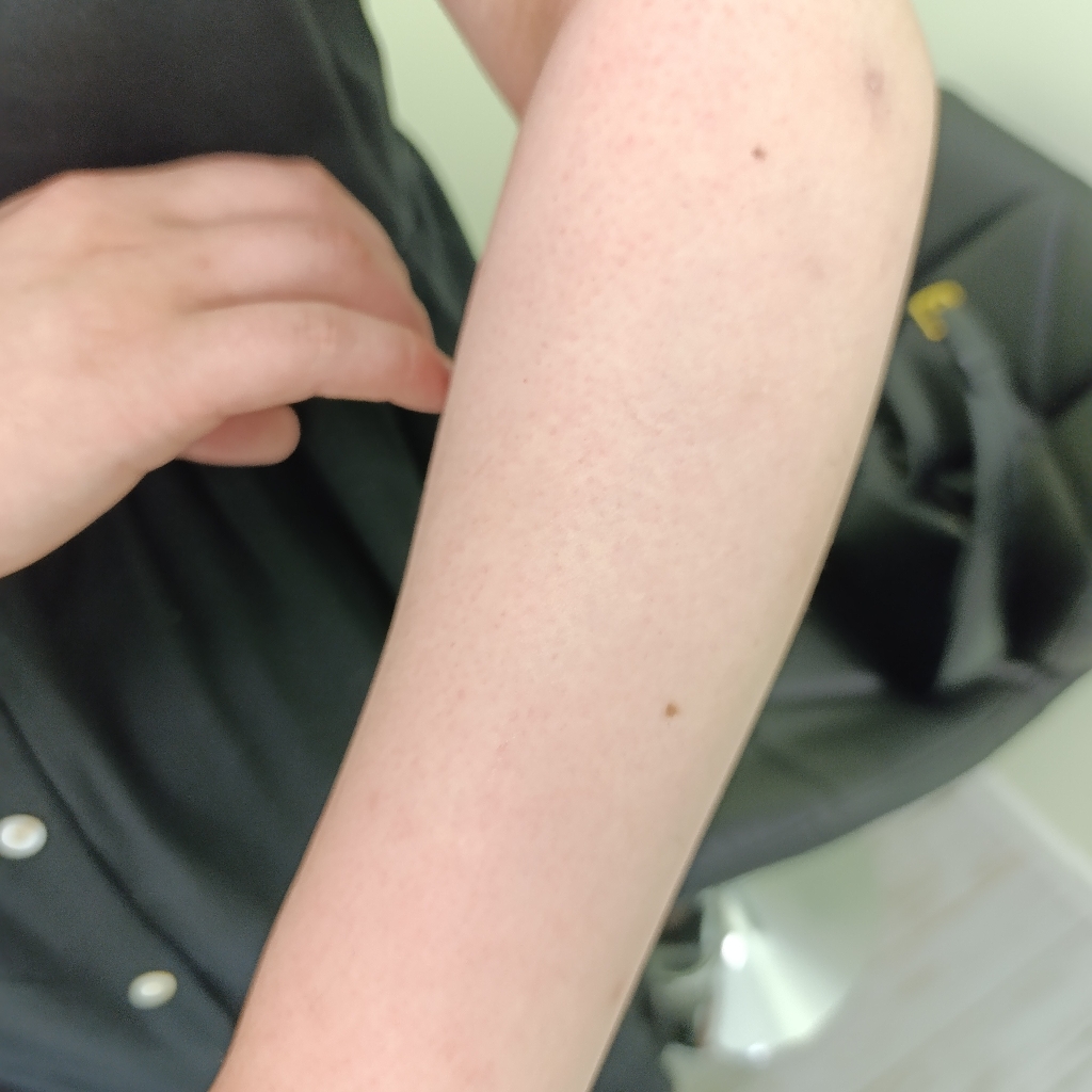 депиляция воском до локтя