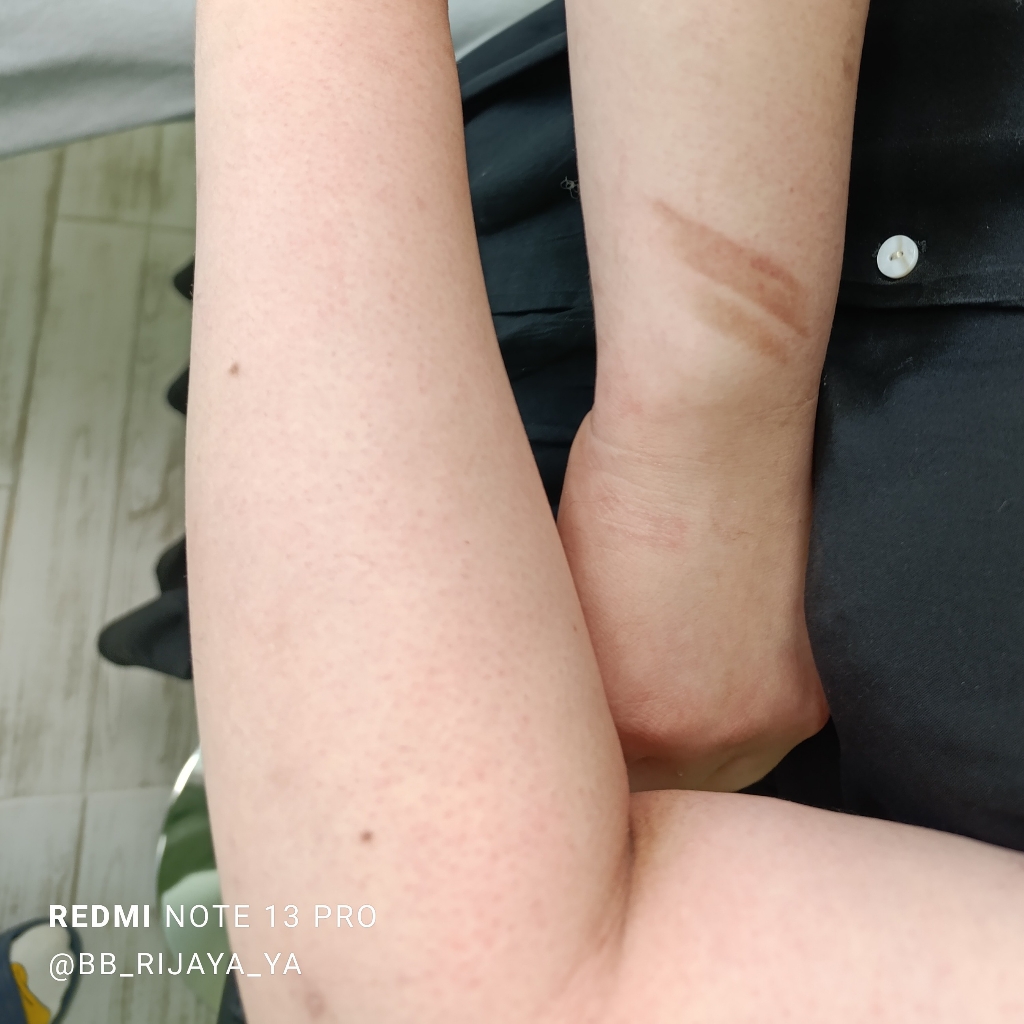 Депиляция воском руки выше локтя