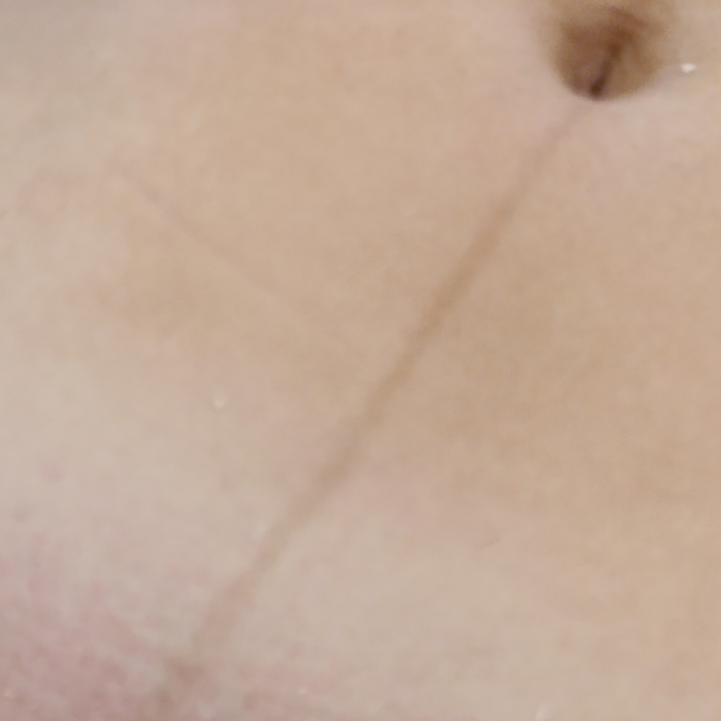 Депиляция воском живот