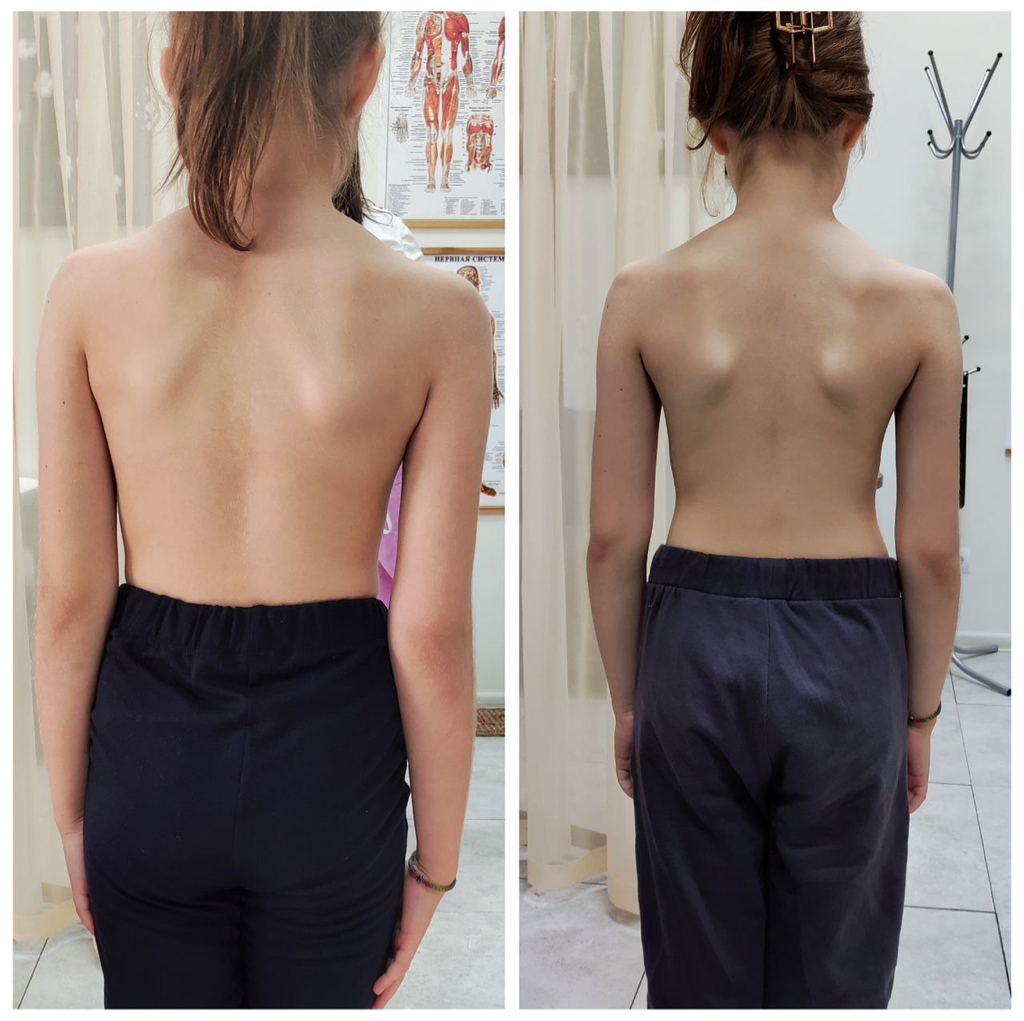 Сеанс телесной гармонии дети от 9-16 лет