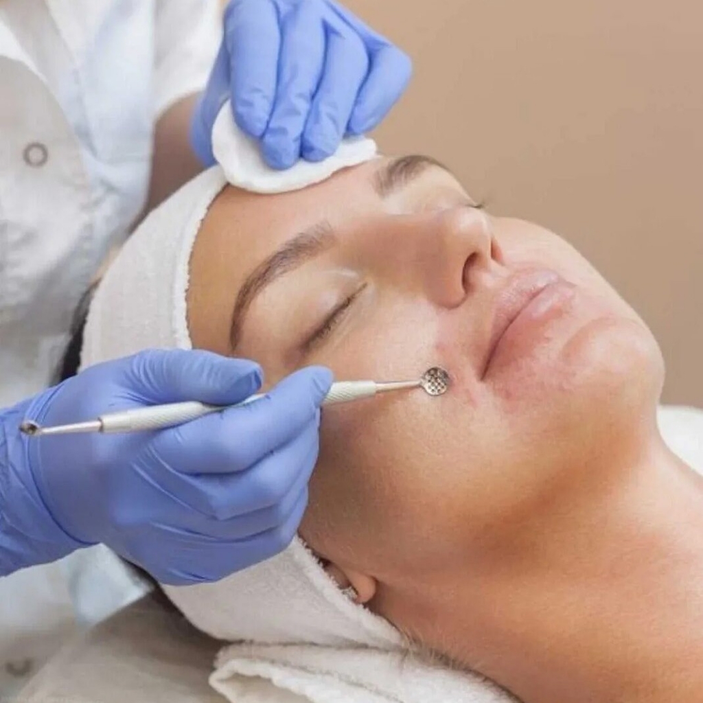 Комбинированная чистка лица