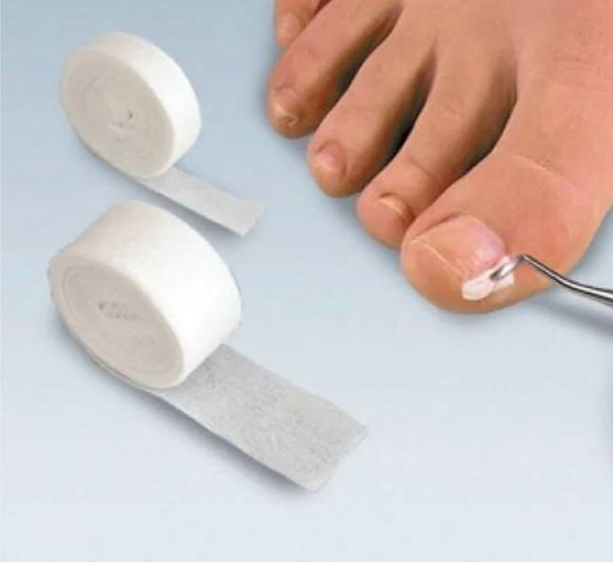 Установка каполина