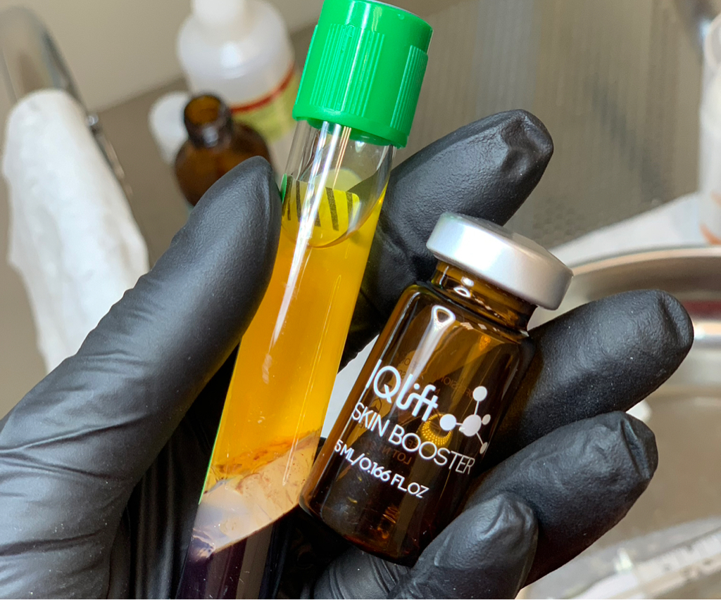 Плазматерапия