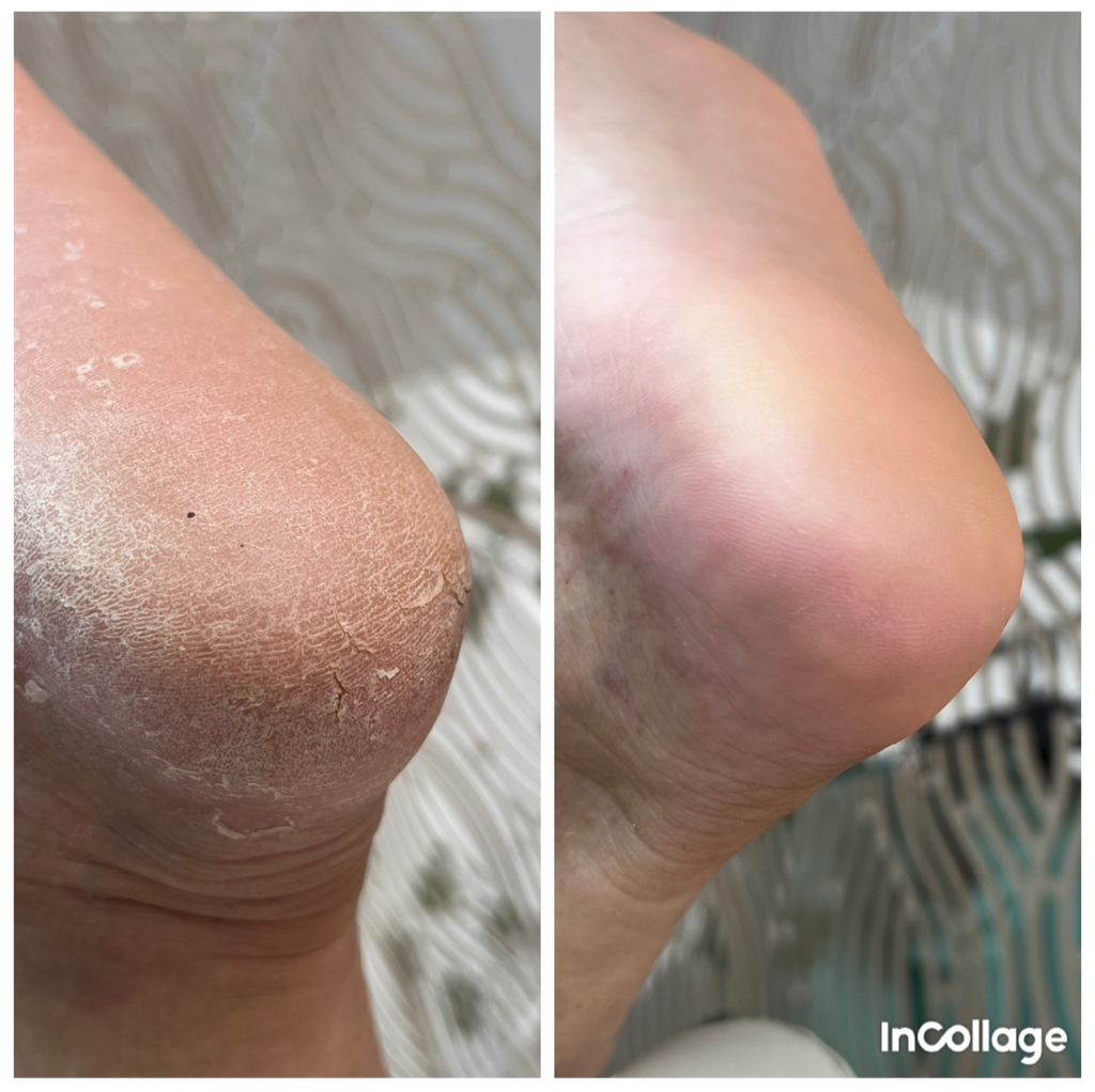 Парамедицинский педикюр 1 категории