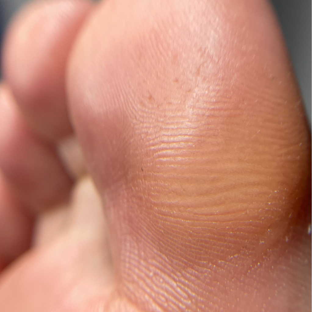 Обработка стоп