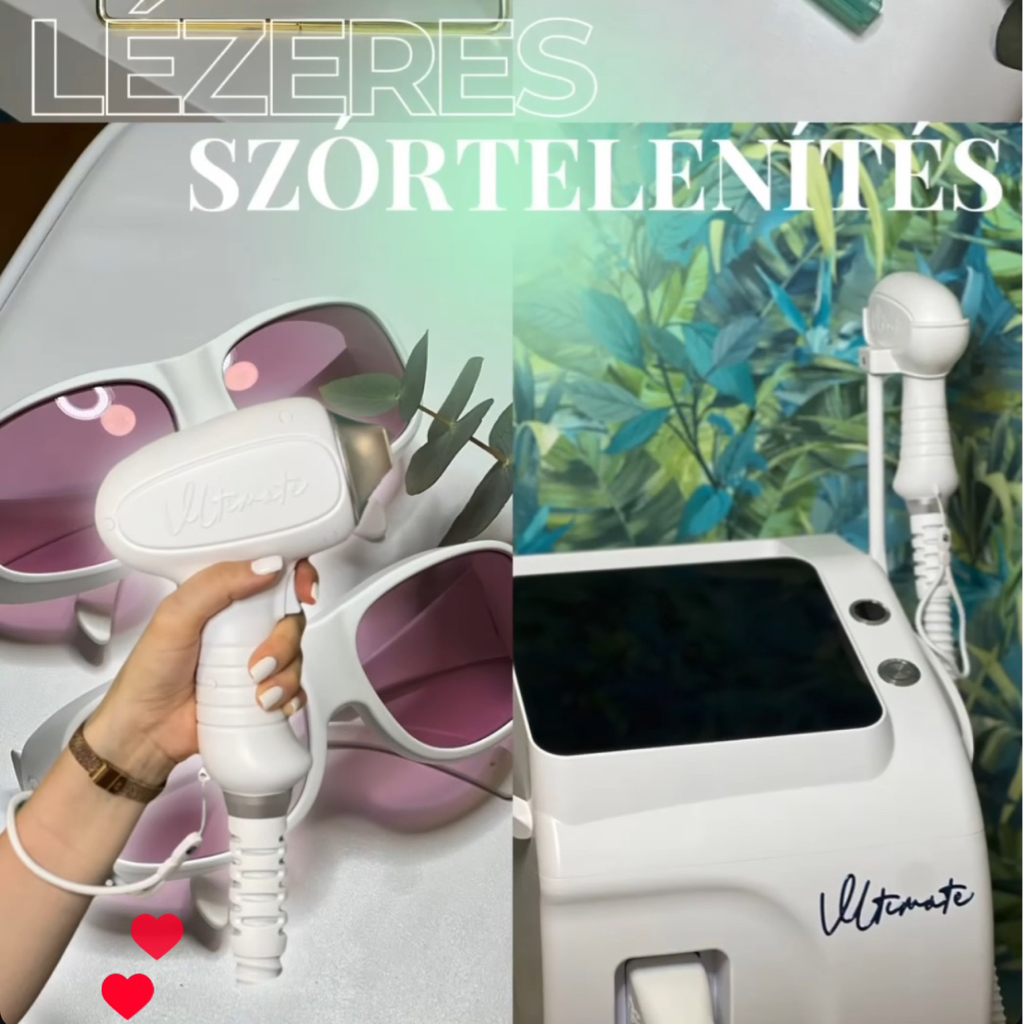 Nyak (női)